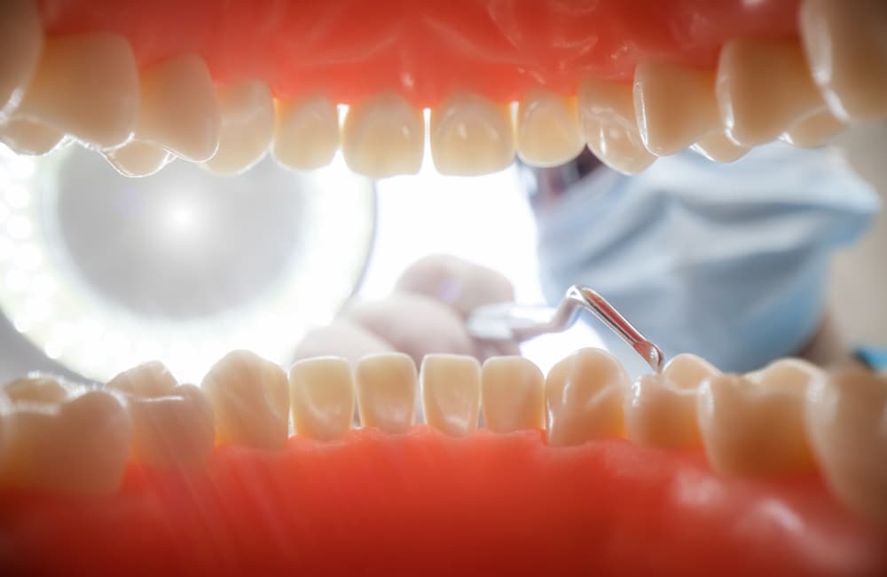 patient at a dentist appointment in a dental clini PYPGEKG 1